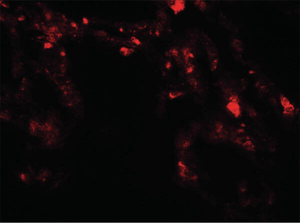 UVRAG Antibody in Immunocytochemistry (ICC/IF)
