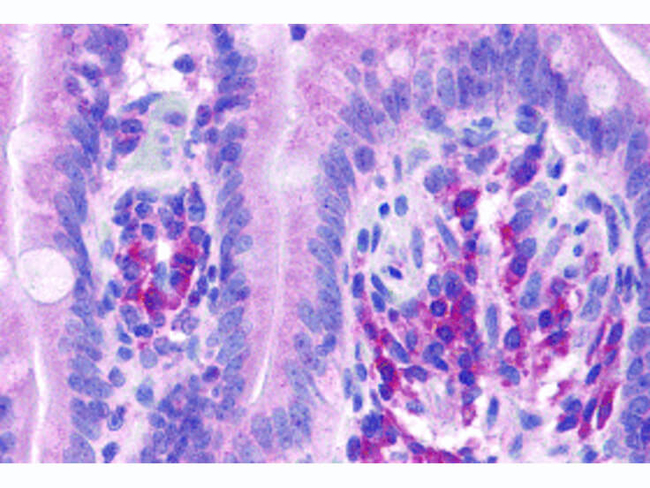VARP Antibody in Immunohistochemistry (Paraffin) (IHC (P))