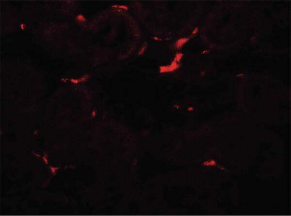VEZT Antibody in Immunocytochemistry (ICC/IF)