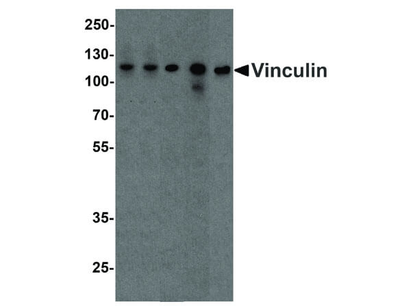 Vinculin Antibody in Western Blot (WB)