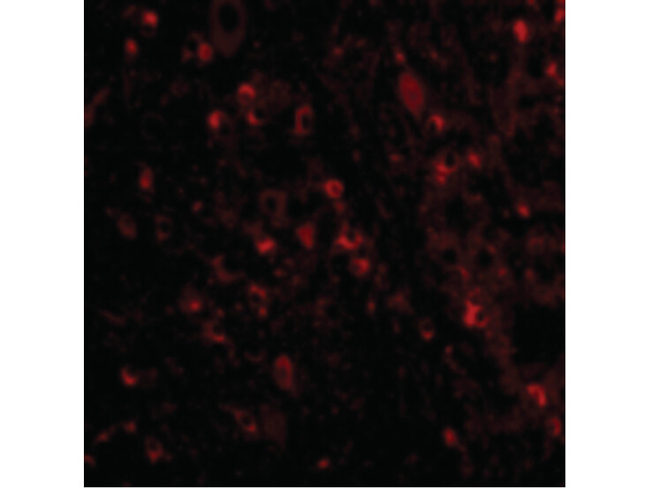 VISA Antibody in Immunocytochemistry (ICC/IF)
