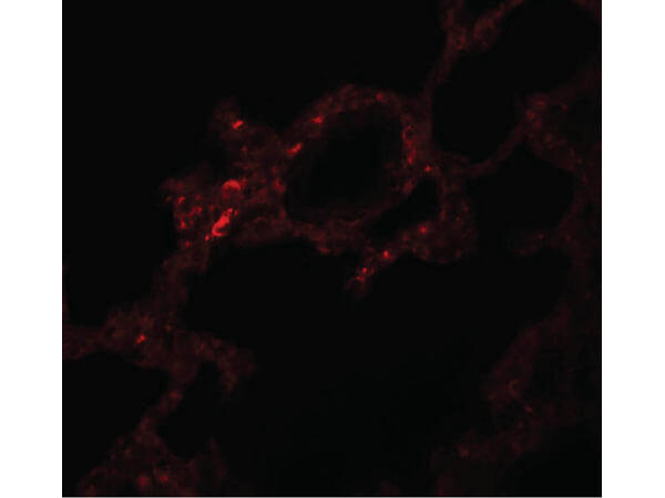 VLK Antibody in Immunocytochemistry (ICC/IF)