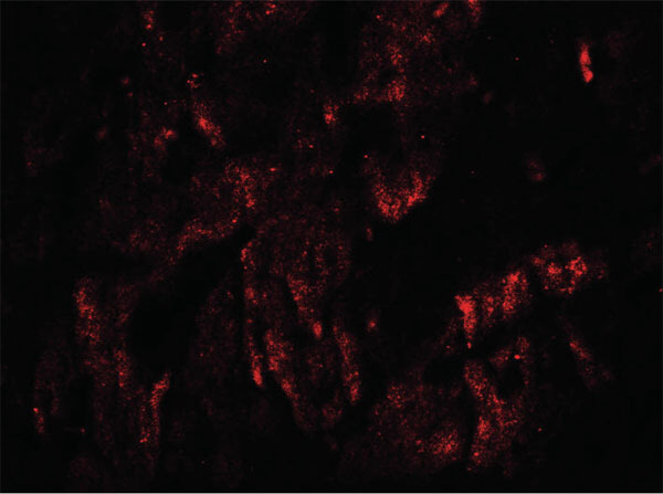 WAPL Antibody in Immunocytochemistry (ICC/IF)