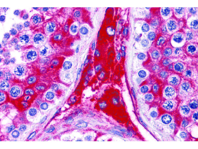 WDR35 Antibody in Immunohistochemistry (Paraffin) (IHC (P))