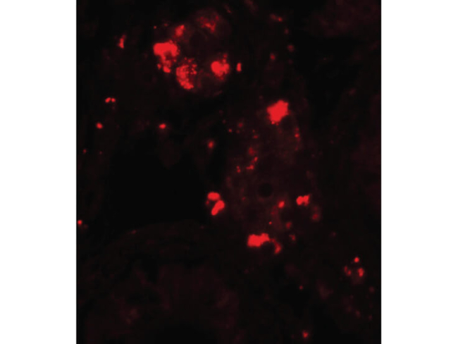 WDR92 Antibody in Immunocytochemistry (ICC/IF)