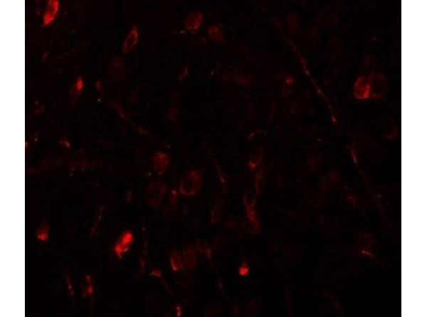 WIZ Antibody in Immunocytochemistry (ICC/IF)