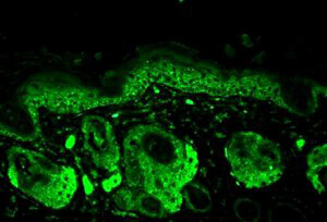 SOD2 Antibody in Immunohistochemistry (Paraffin) (IHC (P))