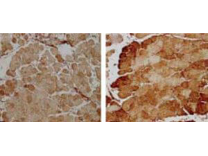 SOD2 Antibody in Immunohistochemistry (Paraffin) (IHC (P))