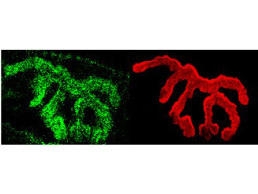 Piccolo Antibody in Immunohistochemistry (IHC)