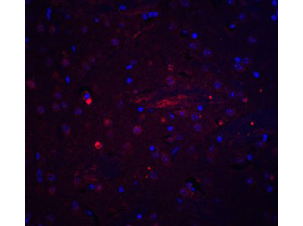 Adiponectin Antibody in Immunocytochemistry (ICC/IF)