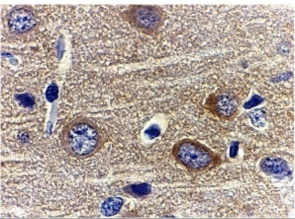 Adiponectin Antibody in Immunohistochemistry (Paraffin) (IHC (P))