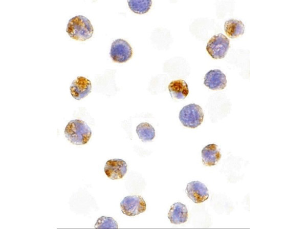 AID Antibody in Immunocytochemistry (ICC/IF)