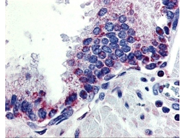 APRIL Antibody in Immunohistochemistry (Paraffin) (IHC (P))