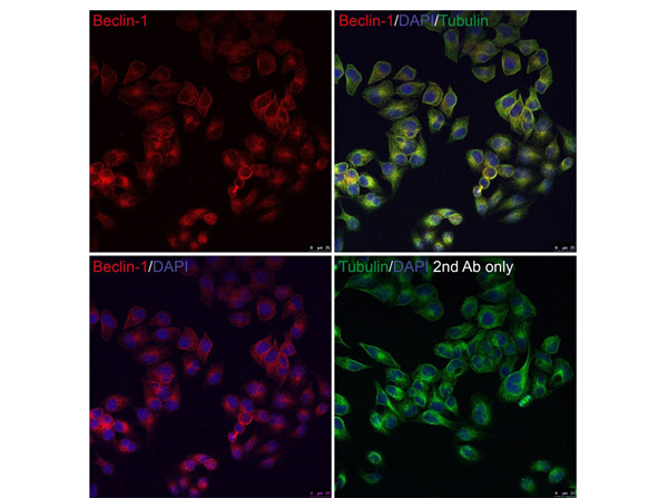 BECLIN1 Antibody in Immunocytochemistry (ICC/IF)