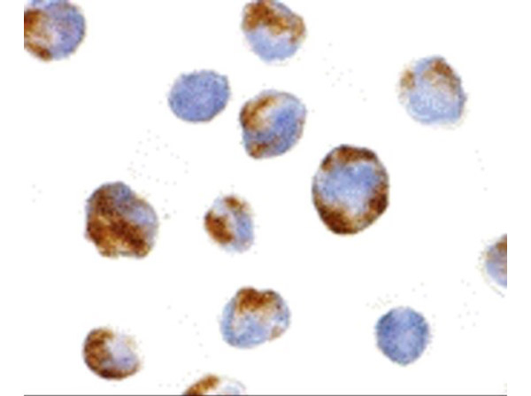 BMI1 Antibody in Immunocytochemistry (ICC/IF)