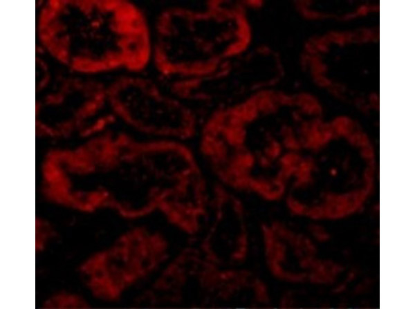 BNIP3L Antibody in Immunocytochemistry (ICC/IF)
