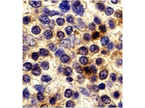 CX3CR1 Antibody in Immunocytochemistry (ICC/IF)
