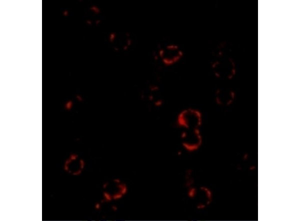 CXCR4 Antibody in Immunocytochemistry (ICC/IF)