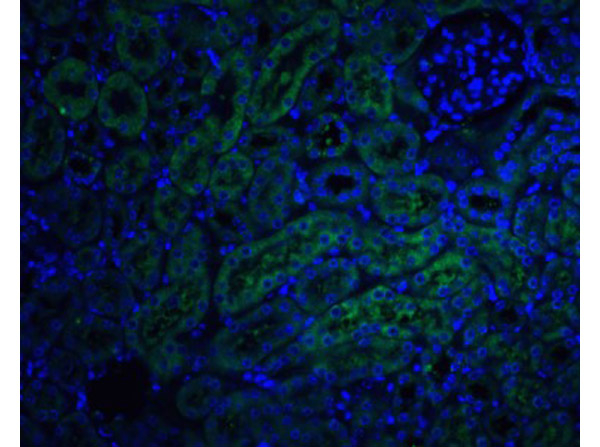 DcR2 Antibody in Immunocytochemistry (ICC/IF)