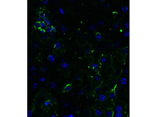 DR5 Antibody in Immunocytochemistry (ICC/IF)