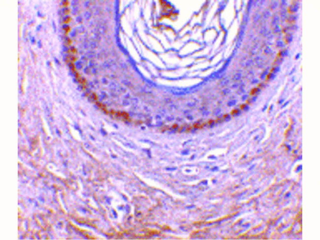 XEDAR Antibody in Immunohistochemistry (Paraffin) (IHC (P))