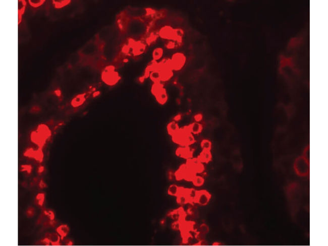 YBX2 Antibody in Immunocytochemistry (ICC/IF)