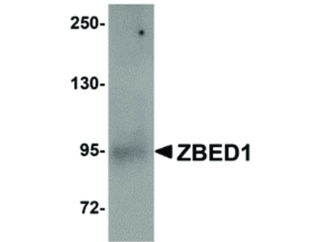 ZBED1 Antibody in Western Blot (WB)
