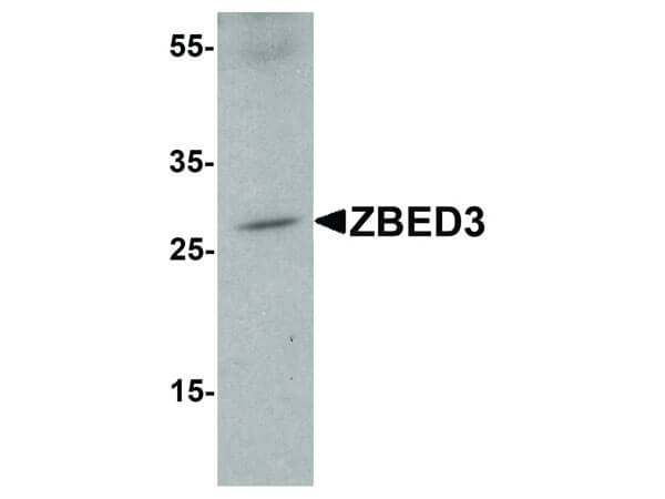 ZBED3 Antibody in Western Blot (WB)