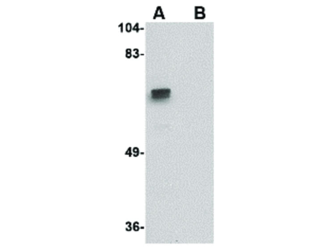 ZBRK1 Antibody in Western Blot (WB)