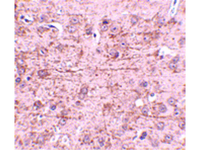ZBTB1 Antibody in Immunohistochemistry (Paraffin) (IHC (P))