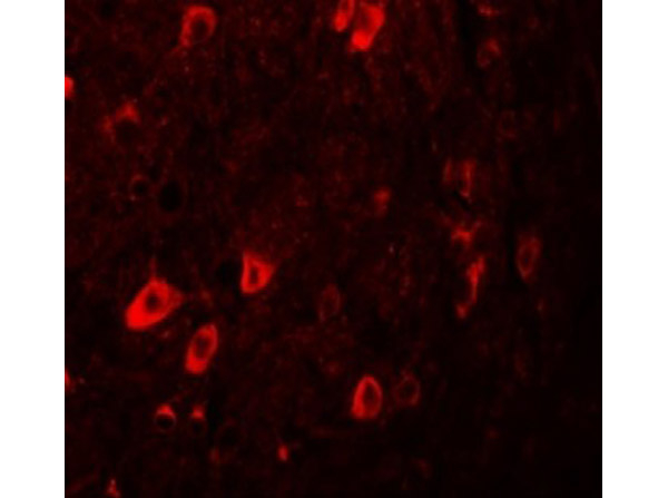 ZBTB3 Antibody in Immunocytochemistry (ICC/IF)