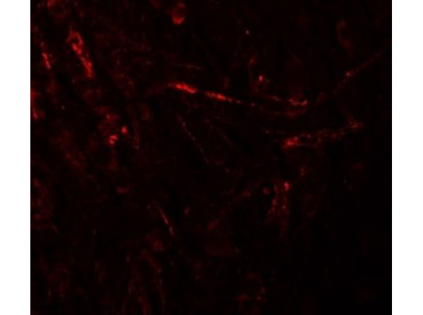 ZBTB4 Antibody in Immunocytochemistry (ICC/IF)