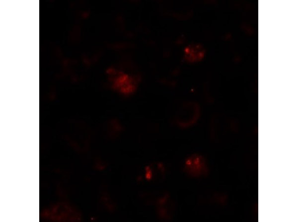 ZBTB6 Antibody in Immunocytochemistry (ICC/IF)