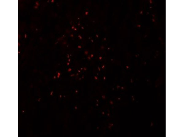 ZBTB7A Antibody in Immunocytochemistry (ICC/IF)