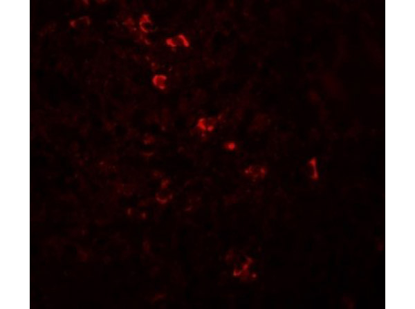 ZBTB8 Antibody in Immunocytochemistry (ICC/IF)