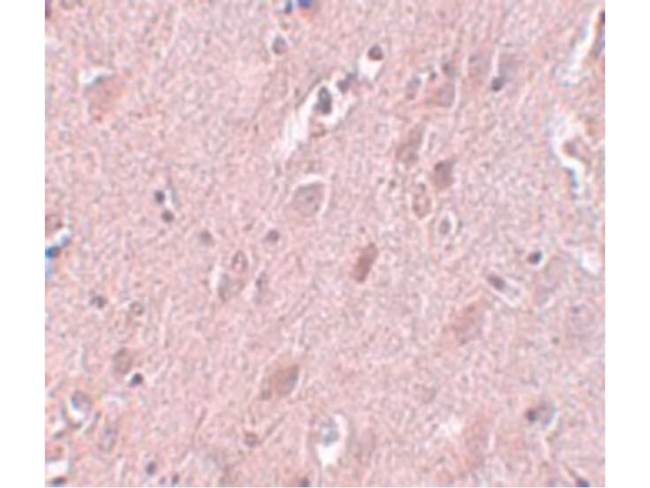 ZC3H12B Antibody in Immunohistochemistry (Paraffin) (IHC (P))