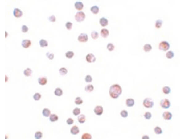 ZC3HAV1 Antibody in Immunocytochemistry (ICC/IF)