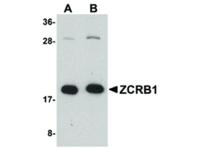 ZCRB1 Antibody in Western Blot (WB)