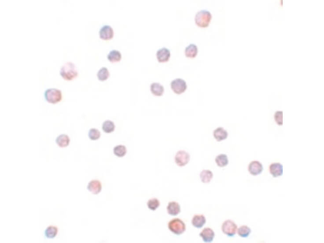 ZEB1 Antibody in Immunocytochemistry (ICC/IF)
