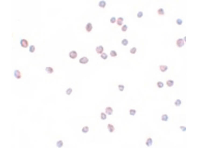 ZEB2 Antibody in Immunocytochemistry (ICC/IF)