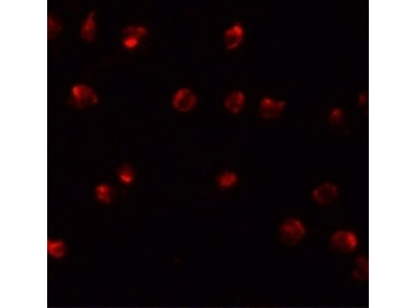ZFP281 Antibody in Immunocytochemistry (ICC/IF)