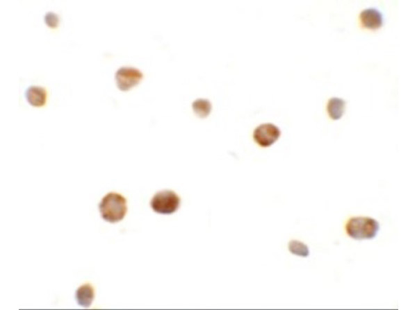 ZHANGFEI Antibody in Immunocytochemistry (ICC/IF)