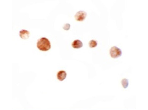 ZIMP10 Antibody in Immunocytochemistry (ICC/IF)