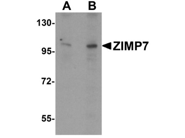 ZIMP7 Antibody in Western Blot (WB)