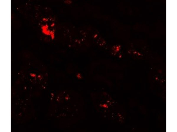ZIP1 Antibody in Immunocytochemistry (ICC/IF)