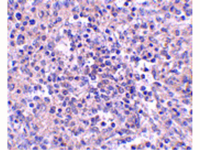 ZIP10 Antibody in Immunohistochemistry (Paraffin) (IHC (P))