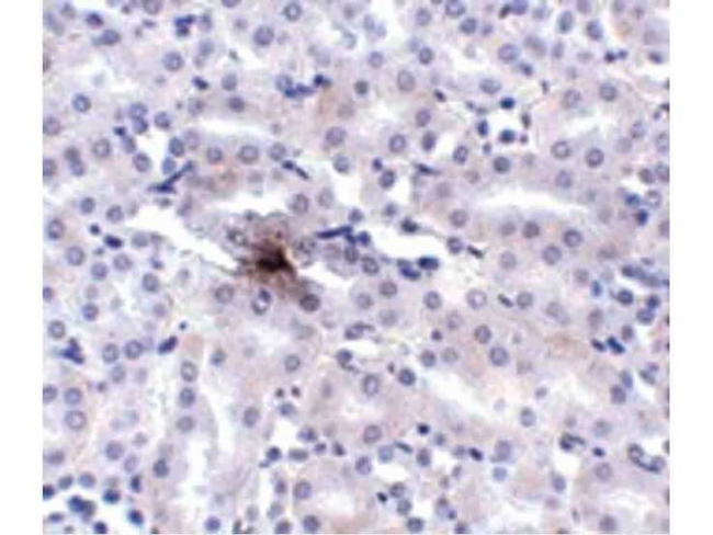 ZIP11 Antibody in Immunohistochemistry (Paraffin) (IHC (P))