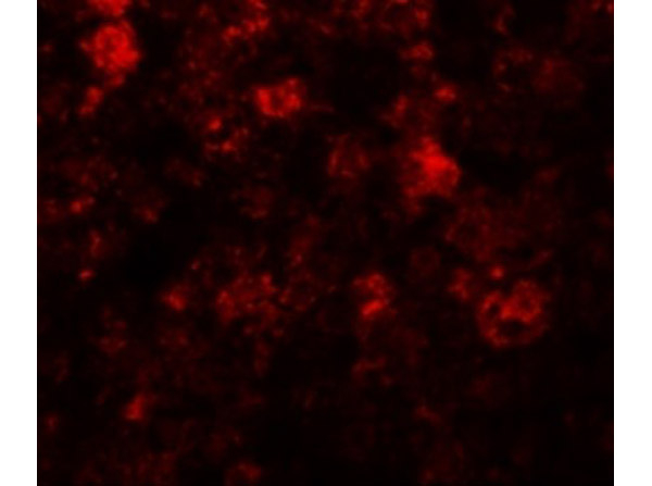 ZIP12 Antibody in Immunocytochemistry (ICC/IF)