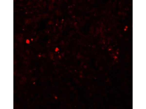 ZIP13 Antibody in Immunocytochemistry (ICC/IF)