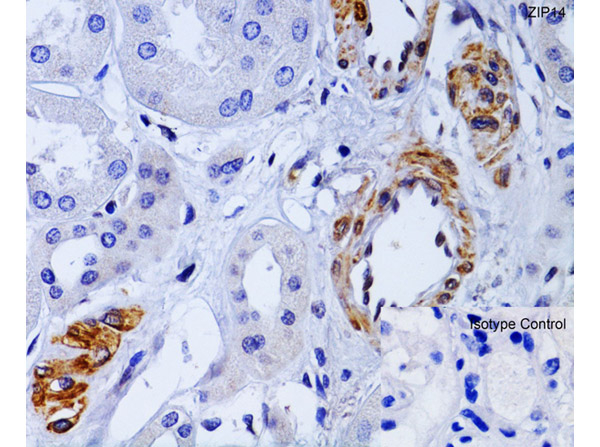 ZIP14 Antibody in Immunohistochemistry (Paraffin) (IHC (P))